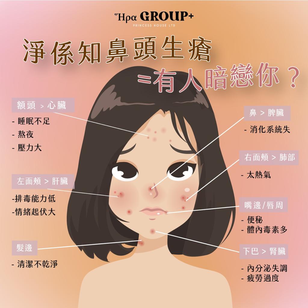 暗瘡位置有原因 – Princess House Limited